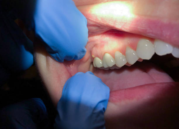 Best Emergency Broken Tooth Repair in Sunset, UT