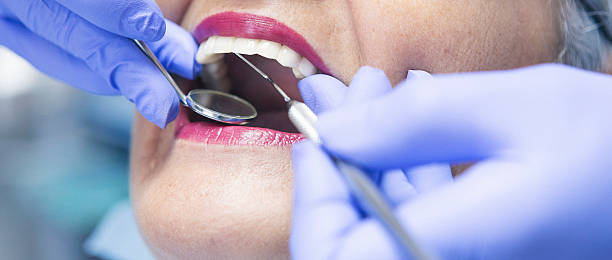 Best Emergency Tooth Extraction in Sunset, UT